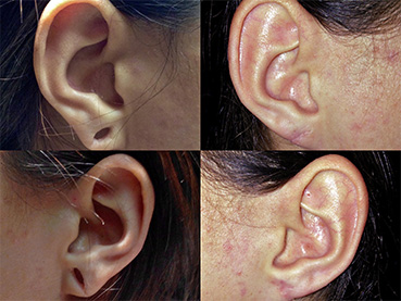 Ear Gauge Repair Female